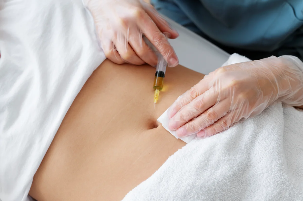 bioestimulador de colágeno no abdomen